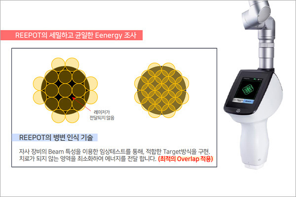 기미색소2